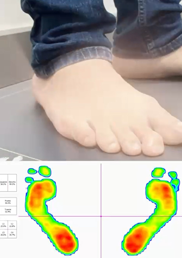 Evaluación estática y del equilibrio